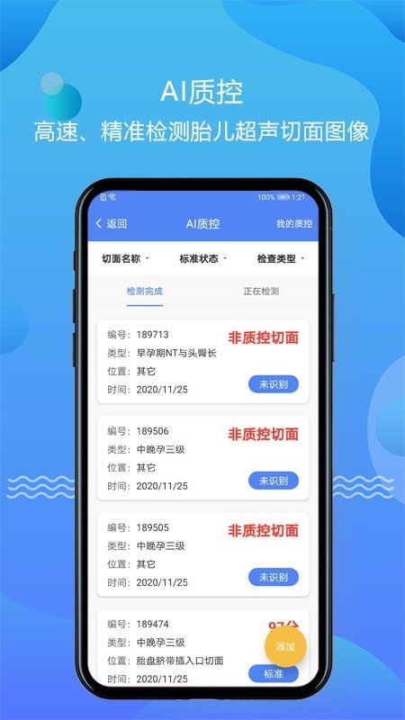 超声智库官方版 v1.2.31 1