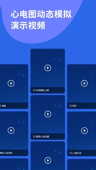 心电图ecg软件 v1.9 安卓版 4