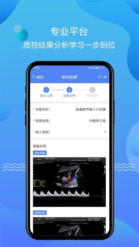 超声智库官方版 v1.2.31 3
